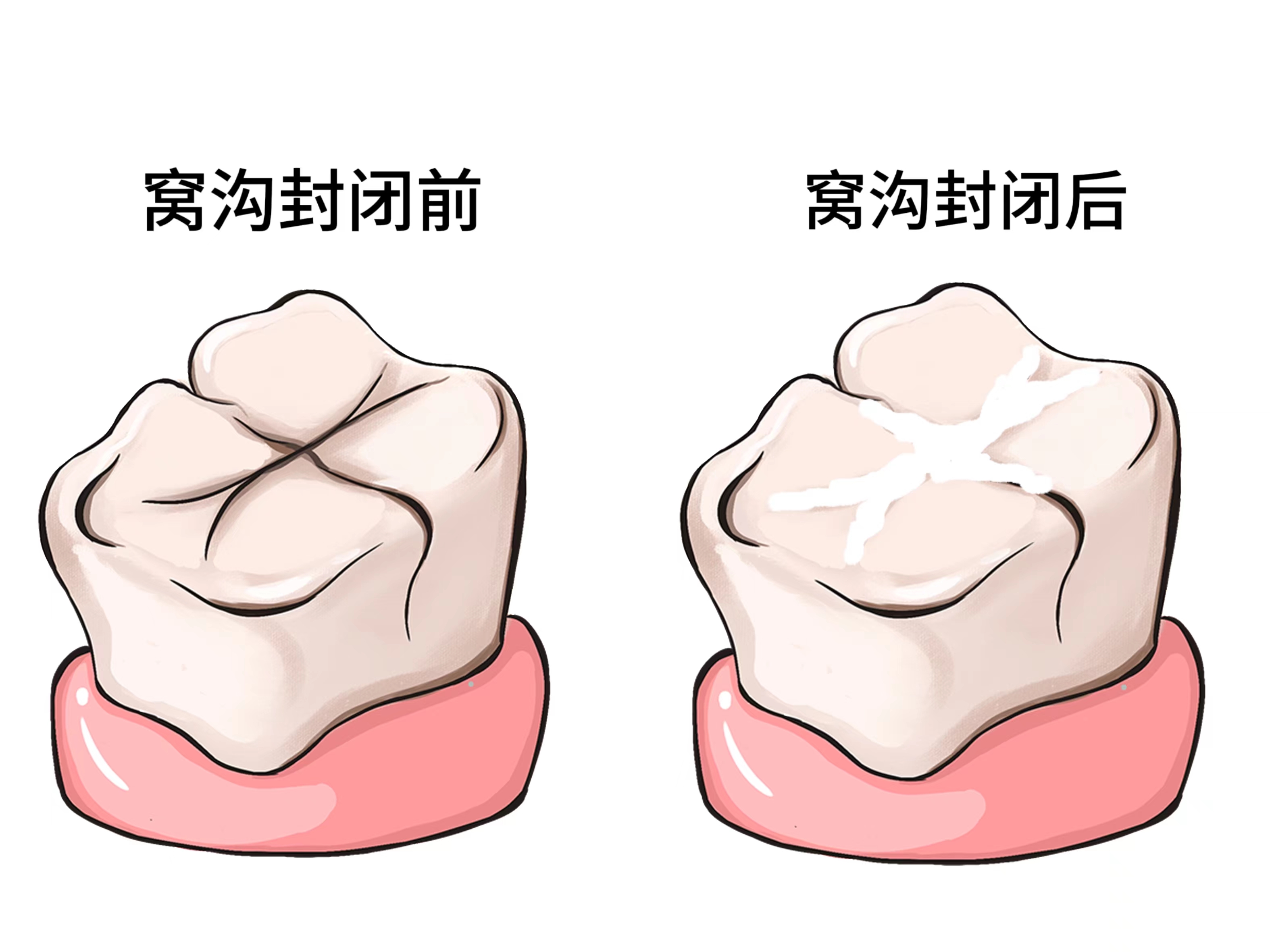许昌看牙价格 许昌看牙价格